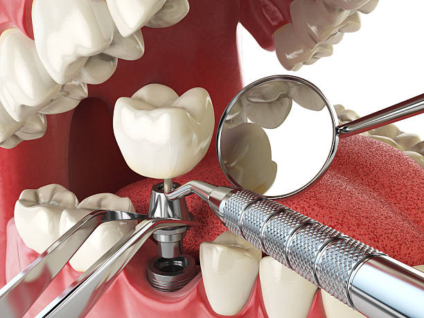 Best Holiday Emergency Dentist in Goshen, CA
